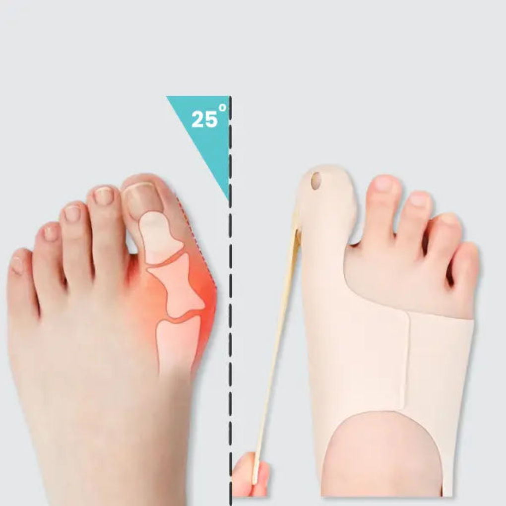 Comfortable Bunion Support Sleeve