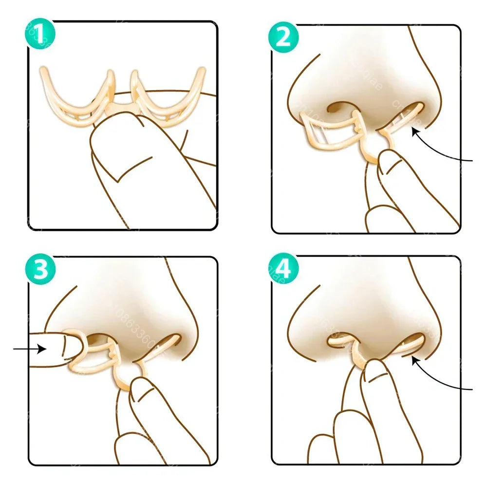 Comfortable Anti-Snoring Device - AirEase-1 piece-Nora Luxe