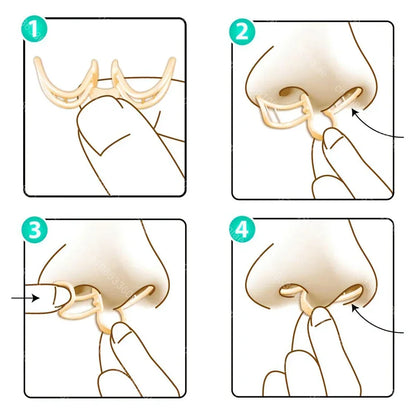 Comfortable Anti-Snoring Device - AirEase-1 piece-Nora Luxe