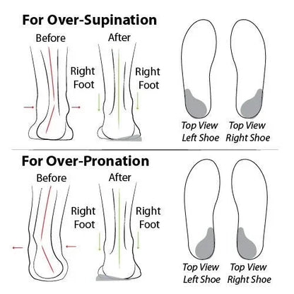 Comfortable orthopedic summer shoes with cushioning – Tessa-Black-7.5-Nora Luxe