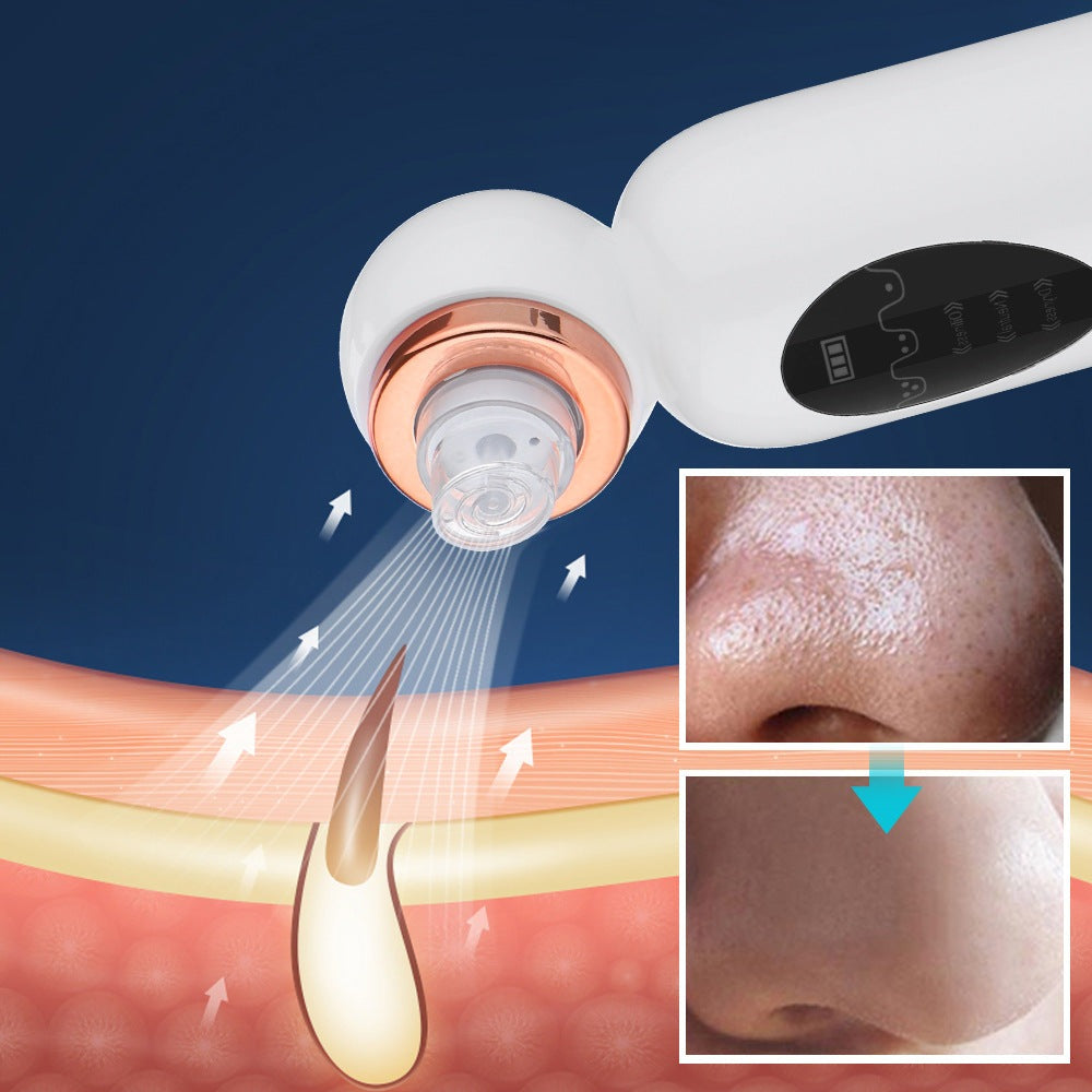 Mee-eter Remover and Hydrodermabrasion - HydraGlow-Nora Luxe