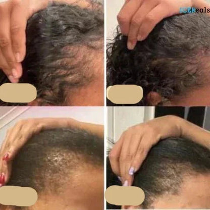 Natural Hair Growth Oil - PureGrowth-1 piece-Nora Luxe