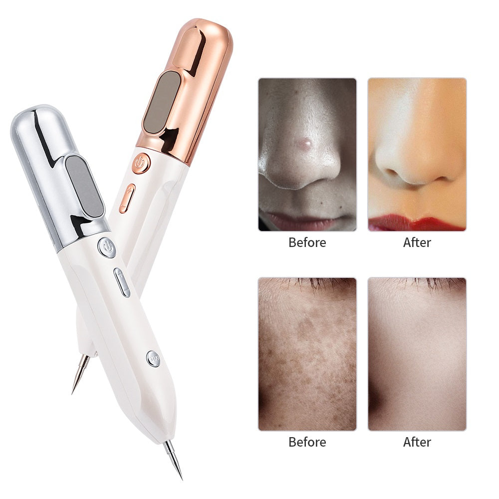 Plasma Skin Rejuvenation Pen - GlowLift-Gold-The Livary