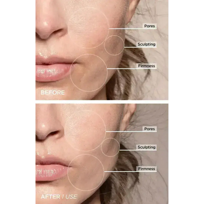 7-in-1 LED Face Firming & Massage Tool – Vénera-White-Nora Luxe