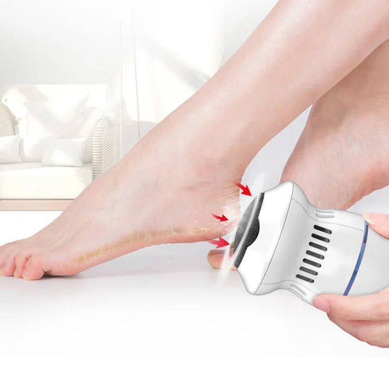 Professional Electric Callus Remover - SoleCare-Nora Luxe