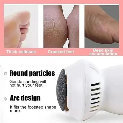 Professional Electric Callus Remover - SoleCare-Nora Luxe